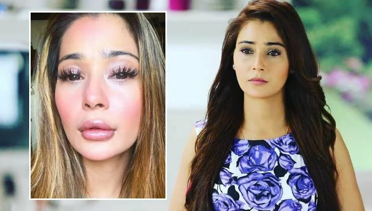 ‘Bidaai’ Actress Sara Khan Opens Up On Her Lip-filler Surgery; Calls It A ‘disaster’